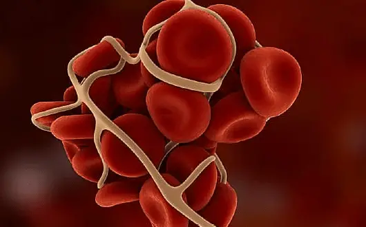 Natural Remedies For Blood Clots
