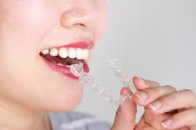How Is Invisalign Made?