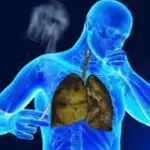 Four Natural Remedies For Chest Congestion